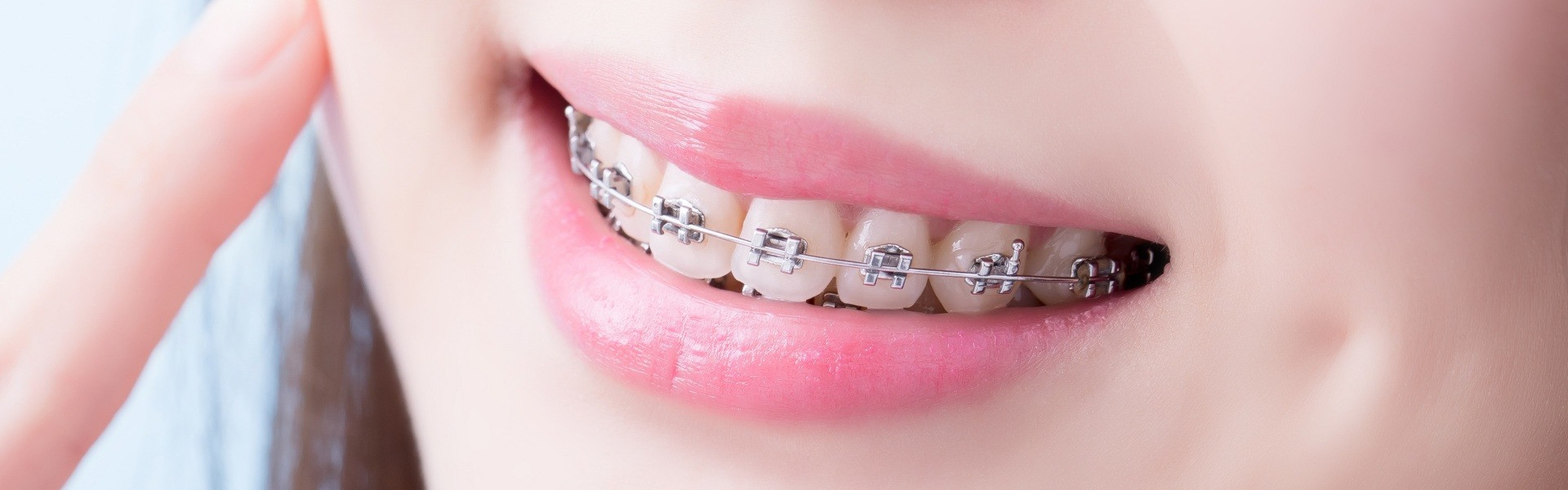 矯正歯科 | 奈良県奈良市の一般歯科・矯正歯科なら福岡歯科・矯正歯科